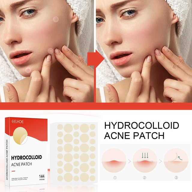 Alt view image 3 of 7 - Invisible Hydrocolloid Acne Patches Waterproof Breathable Facial Spot Cover for Closed Acne Makeup Friendly Care