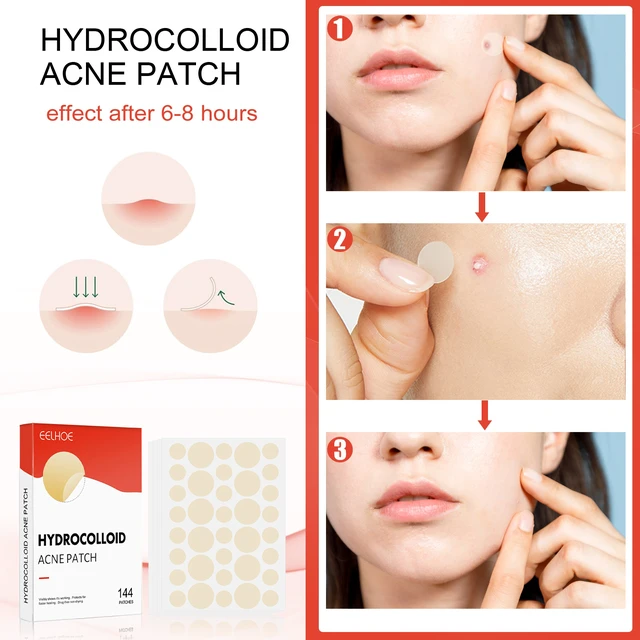 Alt view image 4 of 7 - Invisible Hydrocolloid Acne Patches Waterproof Breathable Facial Spot Cover for Closed Acne Makeup Friendly Care