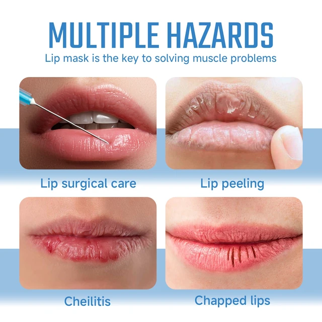 Alt view image 3 of 6 - Hydrating & Patterned Design, Exfoliates Dead Skin, Collagen Lip Mask for Dry Cracked Lips