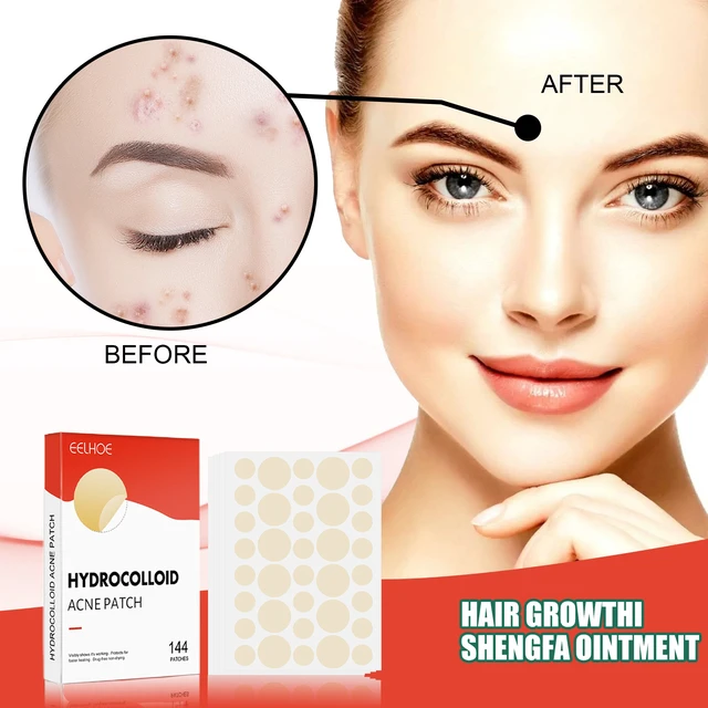 Alt view image 2 of 7 - Invisible Hydrocolloid Acne Patches Waterproof Breathable Facial Spot Cover for Closed Acne Makeup Friendly Care