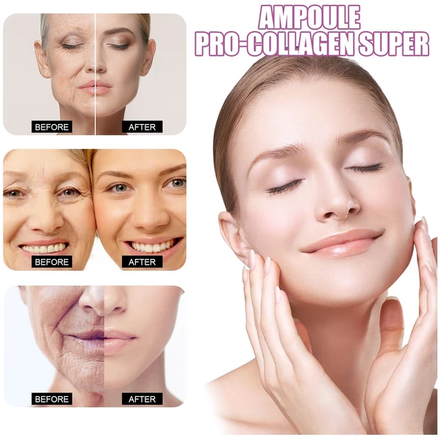 Alt view image 4 of 6 - Hydrating & Radiance Boosting, Ceramide Essence Ampoule for Gentle Skin Barrier Repair