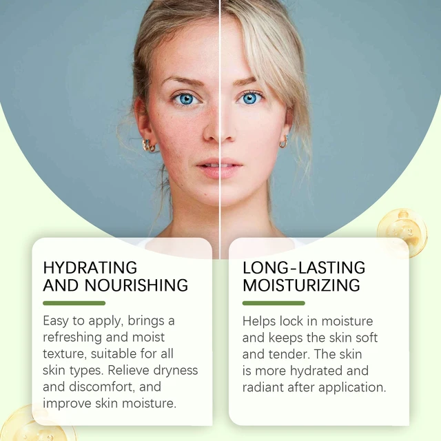 Alt view image 4 of 6 - Aloe Vera Hydrating Gel for Post-Sun Care and Sensitive Skin Moisturizing Cream