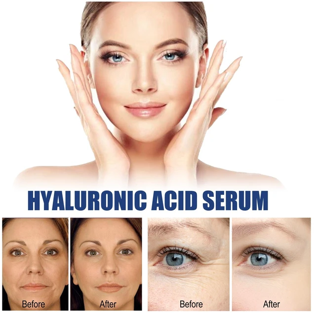Alt view image 4 of 7 - Skin Tightening & Hydration, Anti-Aging Serum for Pore Minimizing