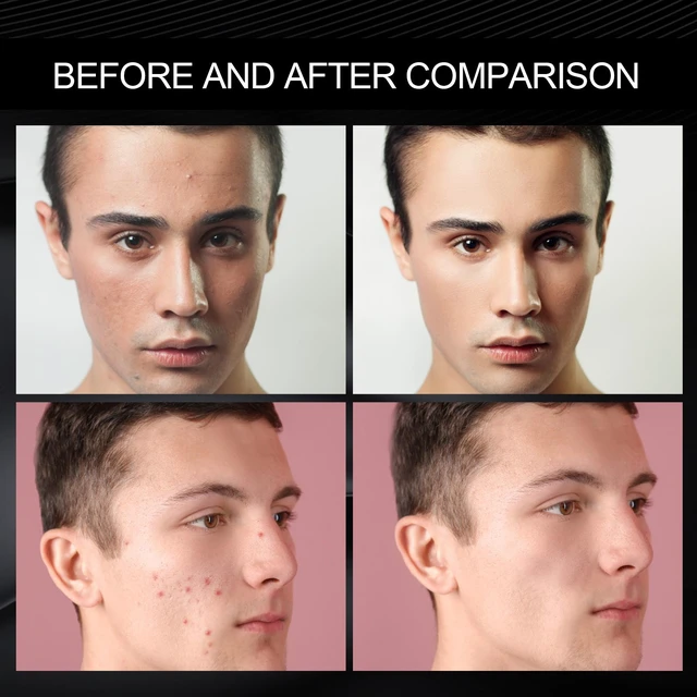 Alt view image 3 of 6 - Hydrating Skin Tone Corrector, Men's Natural Finish Cream Concealer for Acne Scars & Blemishes
