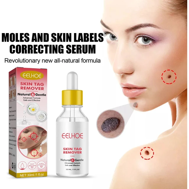 Alt view image 4 of 7 - Eye Area Safe, Targets Neck and Flat Warts, Clover Extract for Mole Removal & Skin Repair