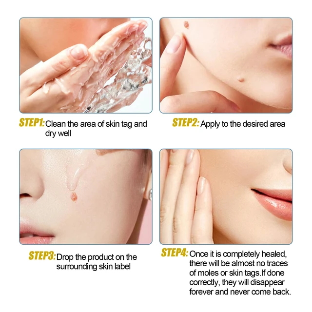Alt view image 6 of 7 - Eye Area Safe, Targets Neck and Flat Warts, Clover Extract for Mole Removal & Skin Repair
