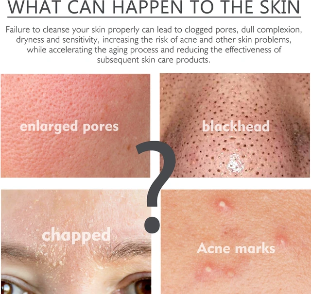 Alt view image 2 of 5 - Clears Pores & Blackheads, Softens Dead Cells, Oligopeptide Facial Cleanser Foam Essence - Brightens Skin