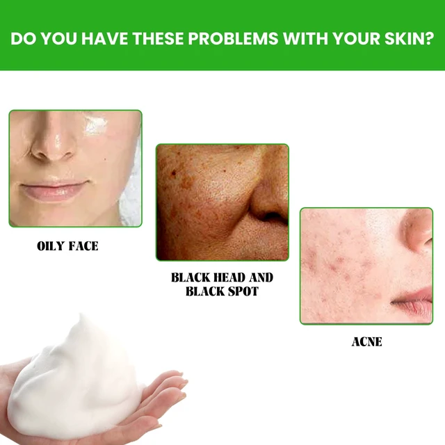 Alt view image 3 of 6 - Acne Face Wash Deep Cleansing Oil Control Blackhead Removal Pore Minimizing Refreshing Comfortable