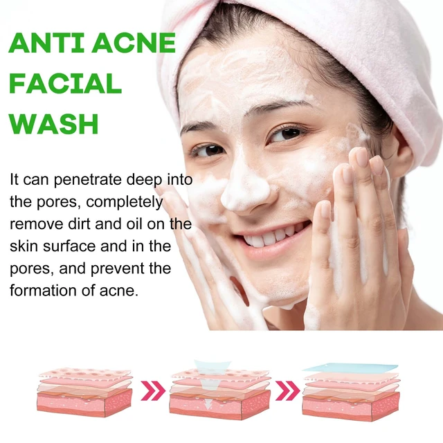 Alt view image 4 of 6 - Acne Face Wash Deep Cleansing Oil Control Blackhead Removal Pore Minimizing Refreshing Comfortable