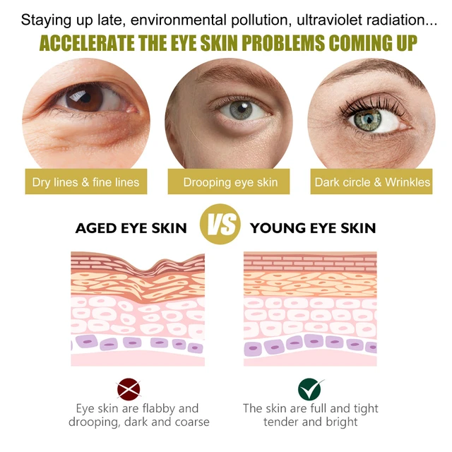 Alt view image 3 of 6 - and Reducing Fine Lines & Dark Circles, Firming, 24K Gold Under Eye Mask for Hydration