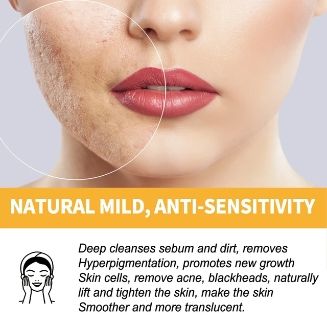 Alt view image 4 of 4 - Gentle Blackhead Removal Facial Treatment, Skin Brightening & Dark Tone Correction, Honey Peel-Off Mask for Pore Minimization