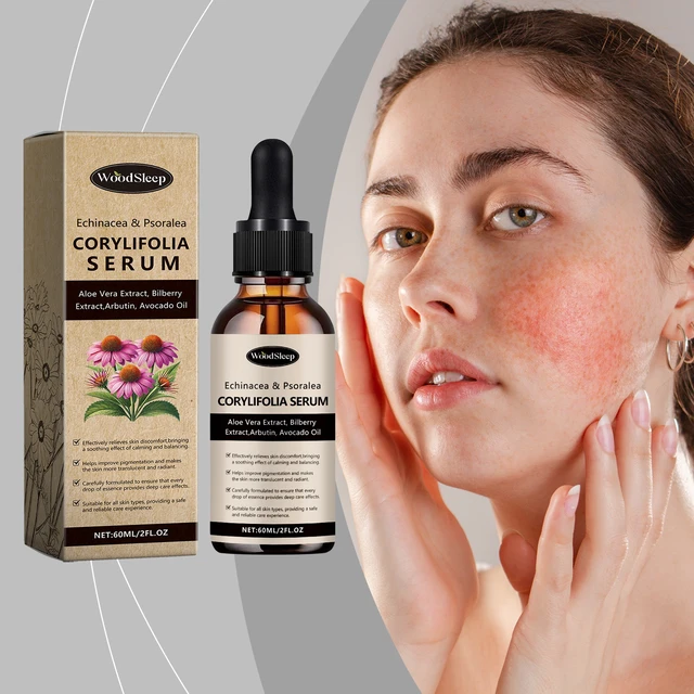 Alt view image 2 of 6 - Echinacea Calming Serum for Redness Relief and Skin Comfort
