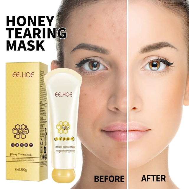 Alt view image 2 of 4 - Gentle Blackhead Removal Facial Treatment, Skin Brightening & Dark Tone Correction, Honey Peel-Off Mask for Pore Minimization