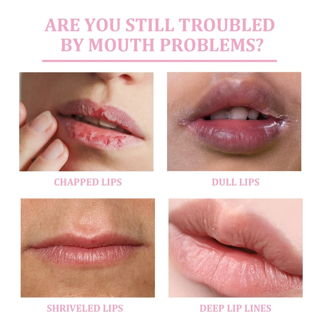 Alt view image 3 of 7 - Lip Scrub Exfoliator Hydrating Moisturizing Care Lip Mist