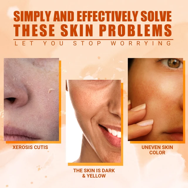 Alt view image 3 of 6 - Brightens & Rejuvenates, Fades Acne Marks, Hydrating Facial Mist - Moisturizes Skin