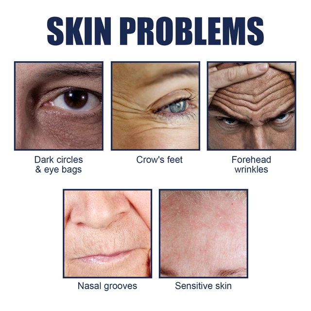 Alt view image 3 of 6 - Men's Forehead Wrinkle Reduction Patch for Fine Lines and Crow's Feet - Skin Tightening Latex Strips