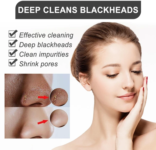 Alt view image 4 of 6 - Tea Tree Oil Blackhead Removal Kit Pore Minimizing Hydrating Essence