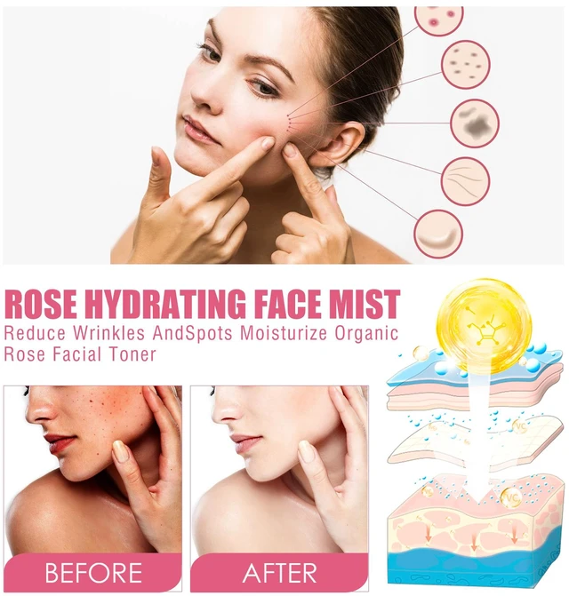 Alt view image 3 of 6 - Oil-Control & Dark Spot Reducing, Rose Face Toner - Refreshing