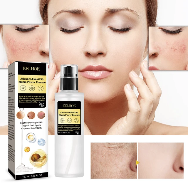 Alt view image 2 of 6 - Hydrating and Moisturizing, Soft Skin & Acne Care, Snail 96 Collagen Essence for Fine Lines