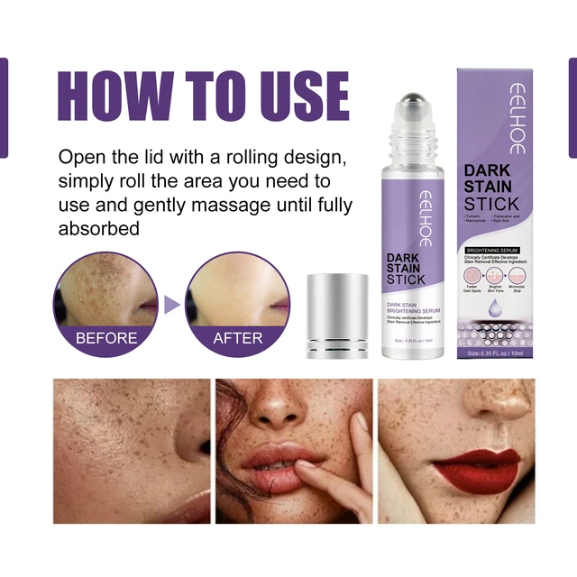 Alt view image 6 of 6 - Hydrating Formula, Skin Whitening & Repair Essence for Melasma and Hyperpigmentation, Dark Spot Corrector Serum