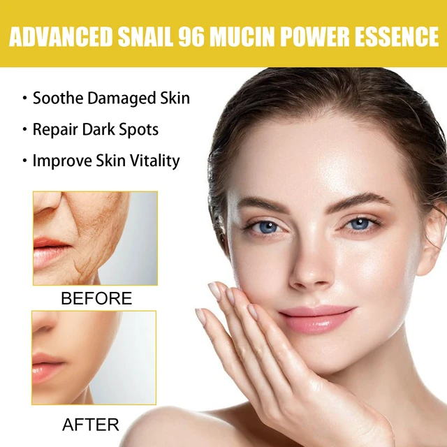Alt view image 4 of 6 - Hydrating and Moisturizing, Soft Skin & Acne Care, Snail 96 Collagen Essence for Fine Lines