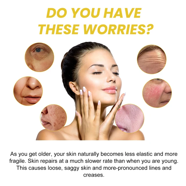 Alt view image 3 of 6 - Hydrating and Moisturizing, Soft Skin & Acne Care, Snail 96 Collagen Essence for Fine Lines
