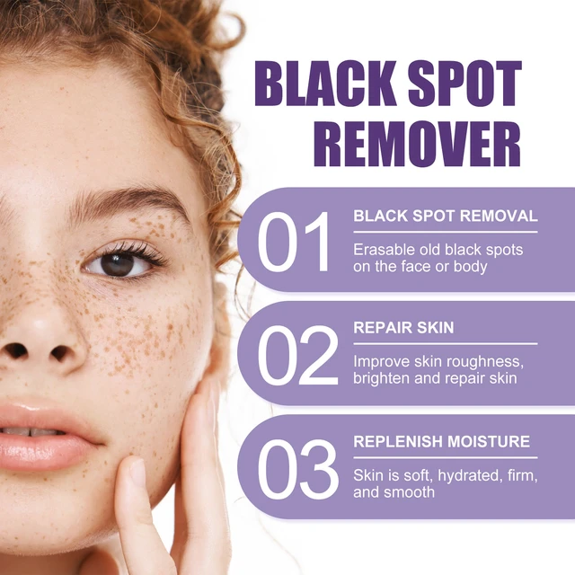 Alt view image 3 of 6 - Hydrating Formula, Skin Whitening & Repair Essence for Melasma and Hyperpigmentation, Dark Spot Corrector Serum