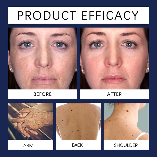 Alt view image 4 of 6 - Refines Texture, Enhances Radiance, Nourishes Skin, Hydrating Essence for Face & Eye