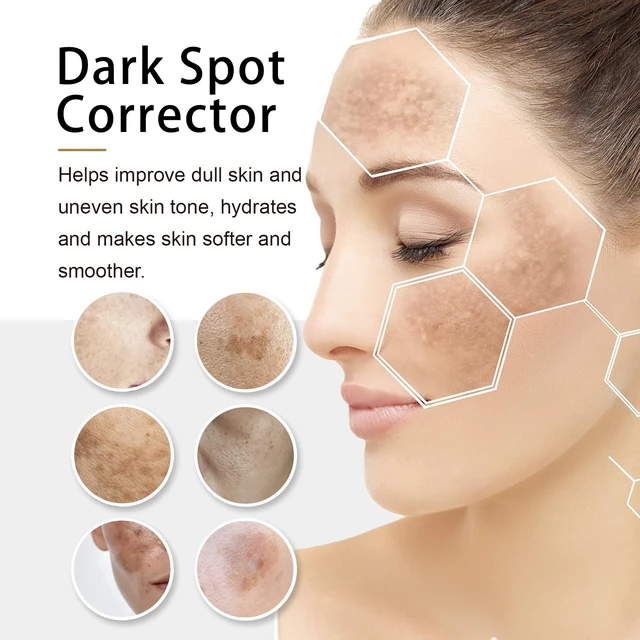 Alt view image 4 of 6 - Evens Tone & Revitalizes Dull Complexion, Skin Brightening Repair Cream - Gentle Moisturizing