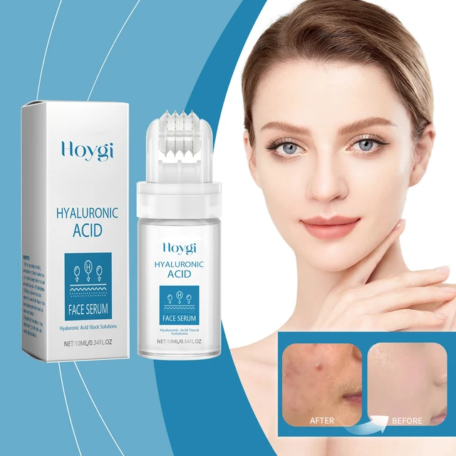 Alt view image 2 of 6 - Hyaluronic Acid Facial Roller Essence for Radiant Skin & Pore Refining