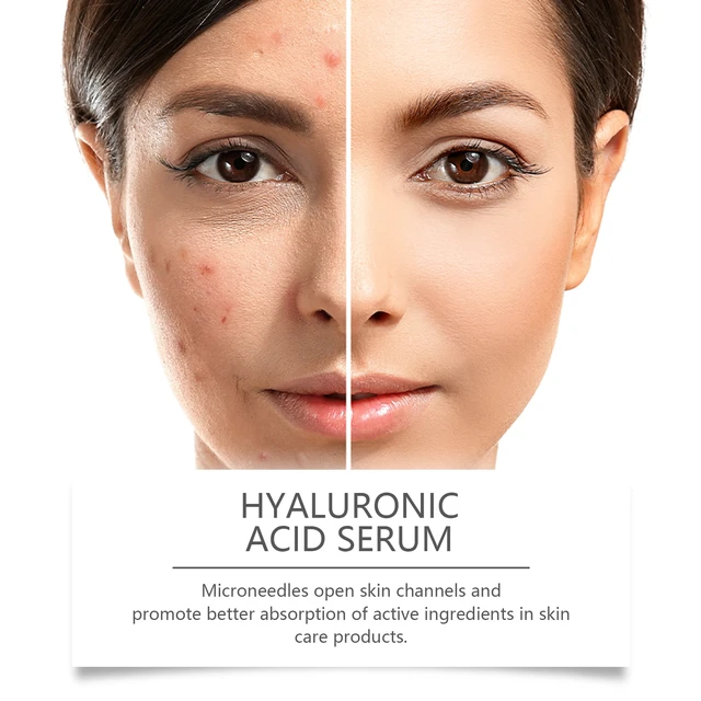 Alt view image 4 of 6 - Hyaluronic Acid Facial Roller Essence for Radiant Skin & Pore Refining