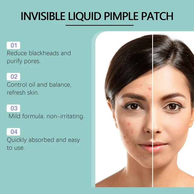 Alt view image 4 of 6 - Deep Cleansing Facial Essence to Minimize Pores, Acne Treatment Serum for Blackheads & Closed Comedones