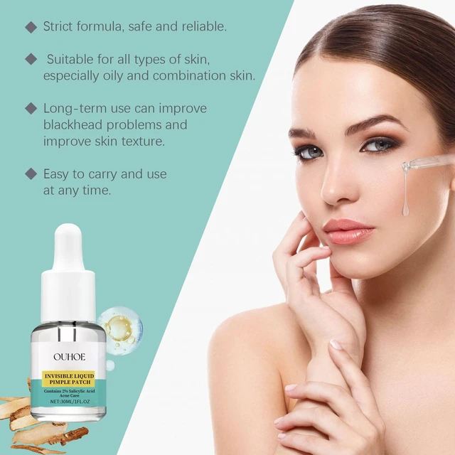 Alt view image 3 of 6 - Deep Cleansing Facial Essence to Minimize Pores, Acne Treatment Serum for Blackheads & Closed Comedones
