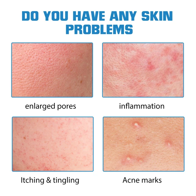 Alt view image 3 of 6 - Hyaluronic Acid Serum Gentle Facial Moisturizer Brightening Care Essence