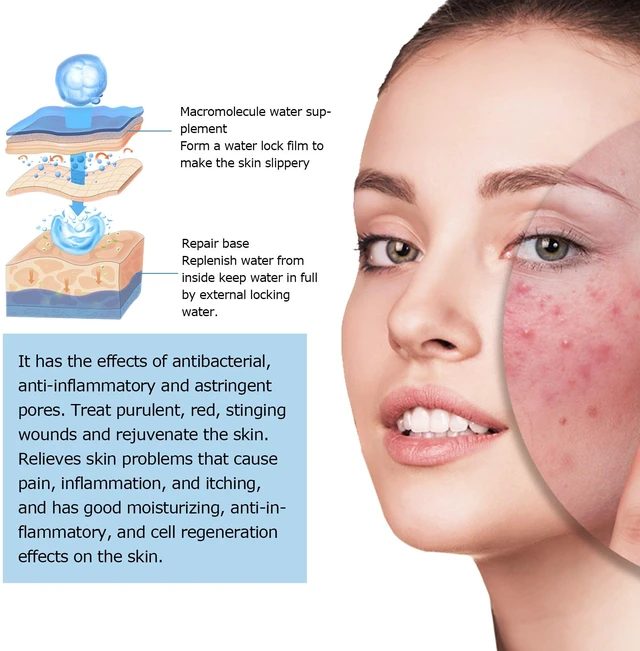 Alt view image 4 of 6 - Hyaluronic Acid Serum Gentle Facial Moisturizer Brightening Care Essence