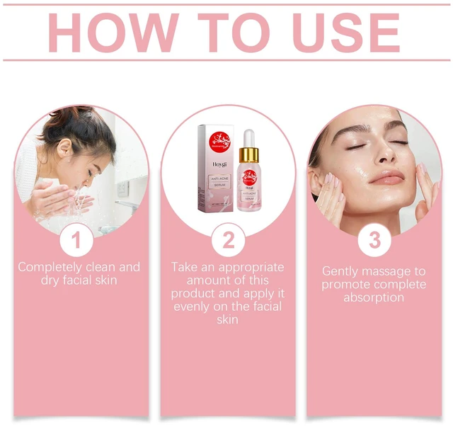 Alt view image 6 of 6 - Niacinamide Acne Care Serum Gentle Blemish Treatment Hydrating Skin Repair Essence