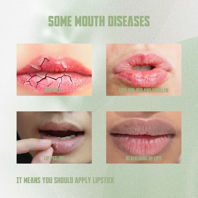 Alt view image 3 of 7 - Protective Lip Stick, Prevents Dryness & Cracking, Hydrating Lip Balm Film - Deep Moisture Care