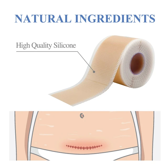 Alt view image 4 of 5 - Lightweight Breathable Silicone Skin Care Patch - Gentle Daily Use for Smooth Comfort