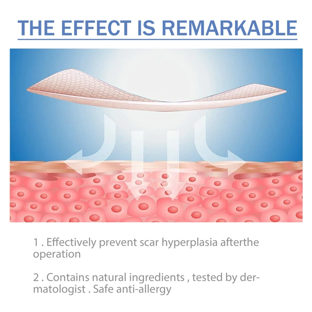 Alt view image 3 of 5 - Lightweight Breathable Silicone Skin Care Patch - Gentle Daily Use for Smooth Comfort