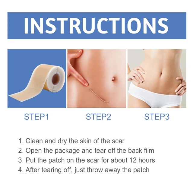 Alt view image 5 of 5 - Lightweight Breathable Silicone Skin Care Patch - Gentle Daily Use for Smooth Comfort