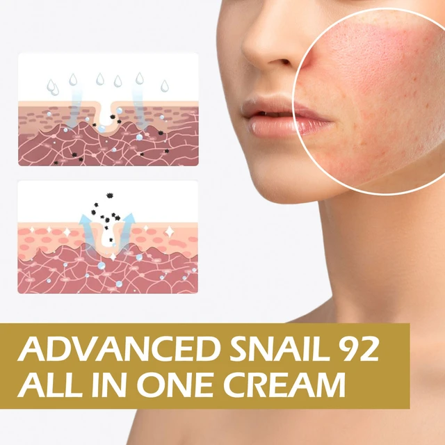 Alt view image 4 of 6 - 92% Snail Repair Cream Acne Scar Removal Hydrating Moisturizing Brightening Firming Face Care