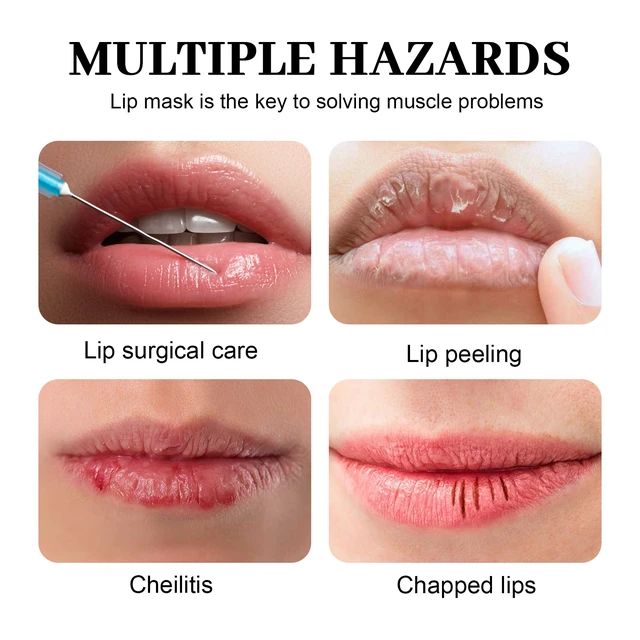 Alt view image 3 of 6 - Cracking and Fine Lines, Smooth & Tender Lips - Relieves Dryness, Hydrating Lip Repair Balm for Plump