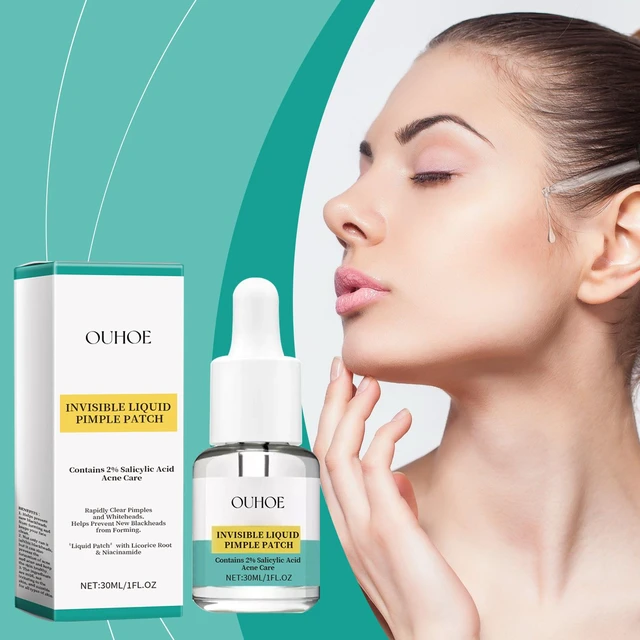Alt view image 2 of 6 - Deep Cleansing Facial Essence to Minimize Pores, Acne Treatment Serum for Blackheads & Closed Comedones