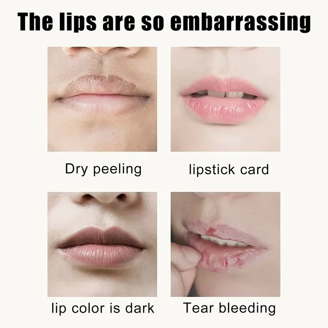 Alt view image 3 of 7 - Fades Lip Lines, Non-Greasy, Moisturizing & Repairing Formula, Cherry Crystal Lip Mask - Hydrating