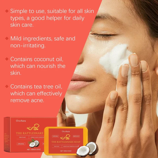 Alt view image 3 of 6 - Handmade Acne Treatment Soap for Oil Control & Pimple Removal - Foaming Vegetable Oil Cleansing Bar