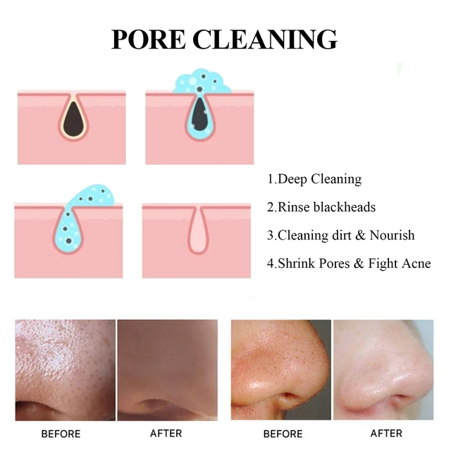 Alt view image 4 of 6 - Oil Control & Moisturizing Peel-Off Pore Care, Deep Cleansing Blackhead Removal Mask