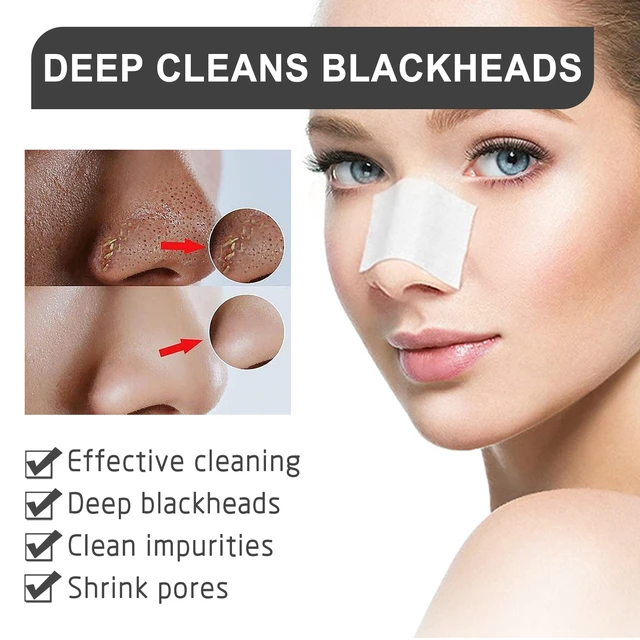 Alt view image 4 of 7 - Nose Blackhead Removal Mask & Moisturizing Care Set