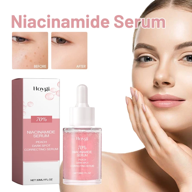 Alt view image 2 of 6 - Niacinamide Facial Essence - Hydrating Moisturizer for Brightening Dull Skin & Minimizing Pores