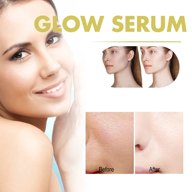 Alt view image 4 of 6 - Propolis Niacinamide Essence Hydrating Skin Brightening Cream Fades Dark Spots & Fine Lines