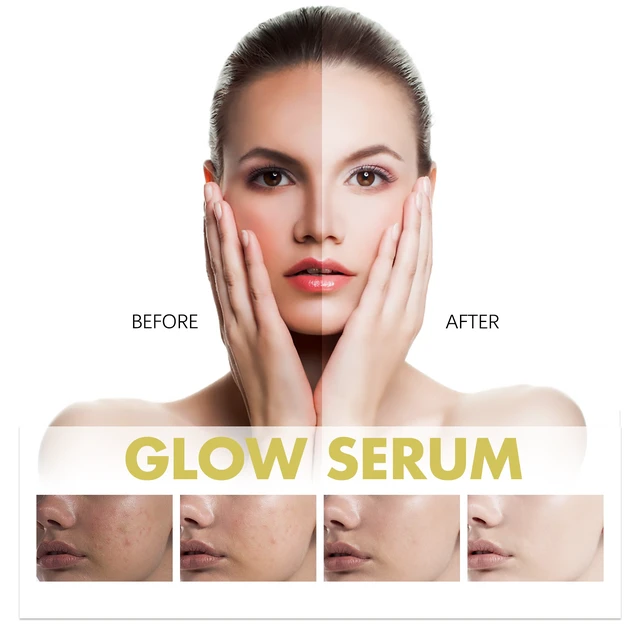 Alt view image 5 of 6 - Propolis Niacinamide Essence Hydrating Skin Brightening Cream Fades Dark Spots & Fine Lines